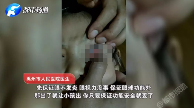 女童眼睛被塞纸片 知道真相所有人都愤怒了